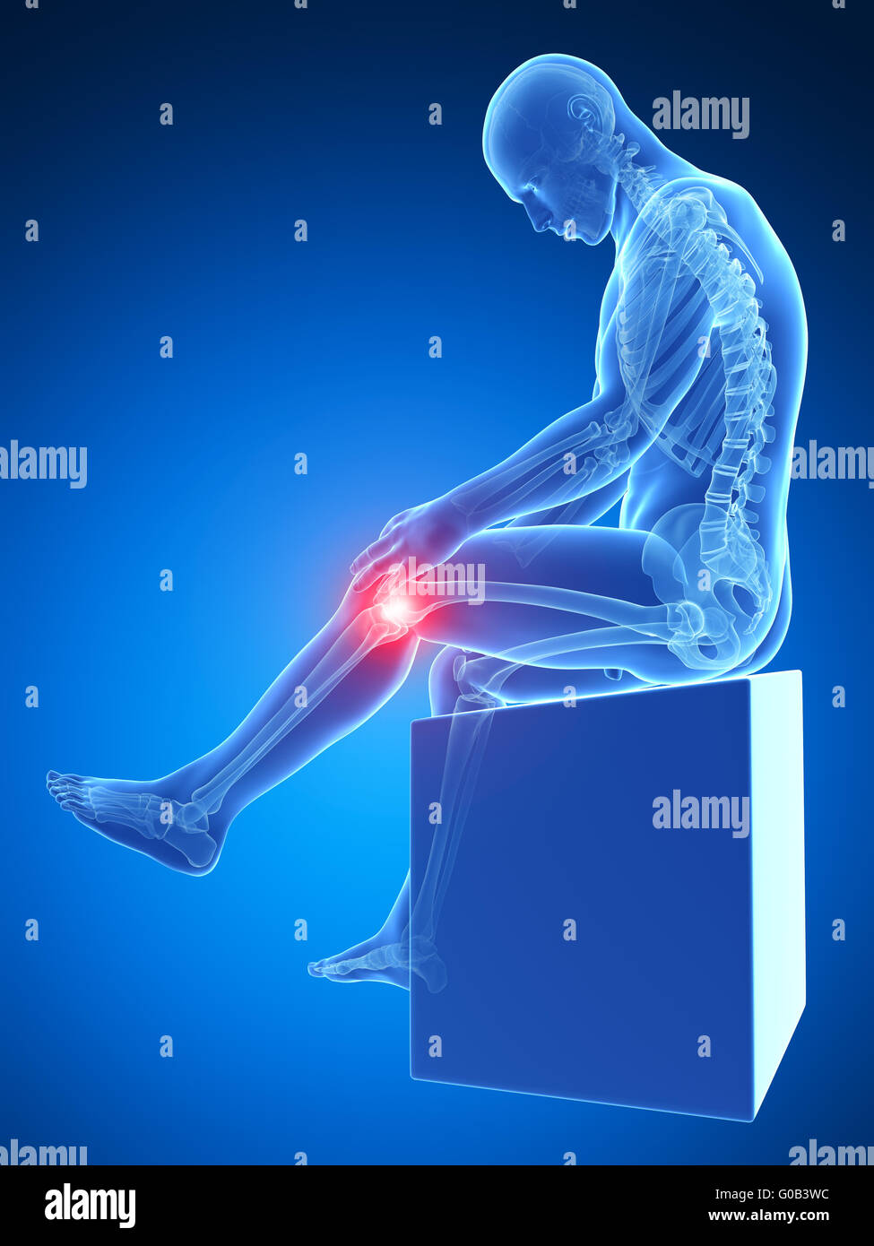 3d rendered medical illustration - painful knee Stock Photo - Alamy