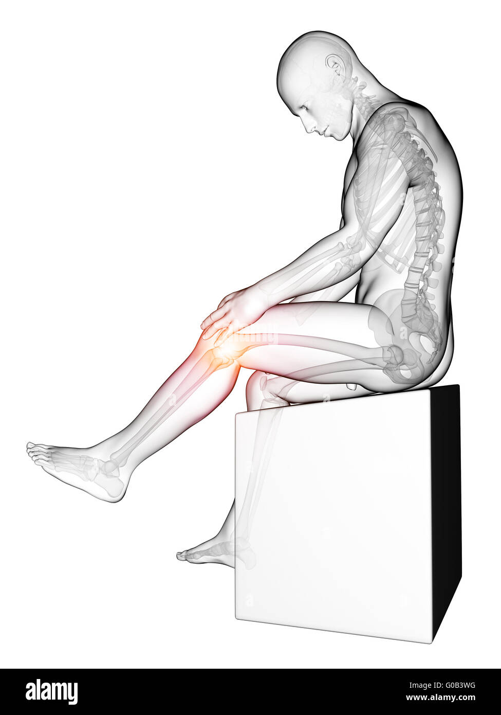 3d rendered medical illustration - painful knee Stock Photo - Alamy