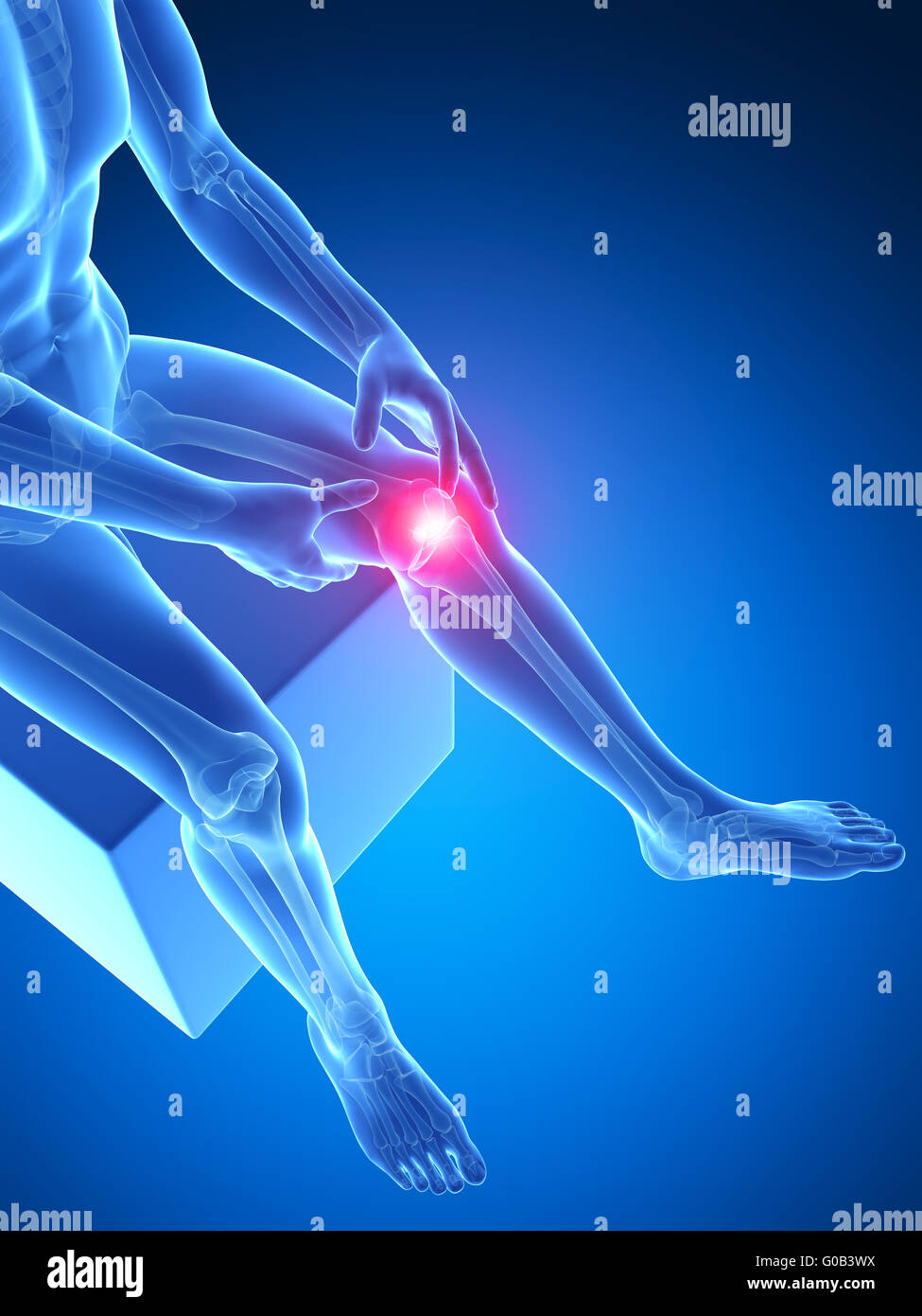 3d rendered medical illustration - painful knee Stock Photo - Alamy