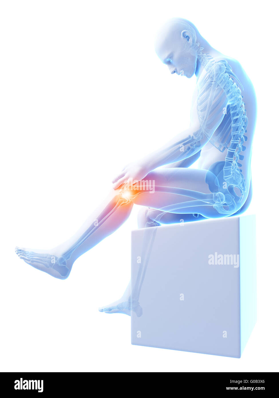 3d rendered medical illustration - painful knee Stock Photo - Alamy