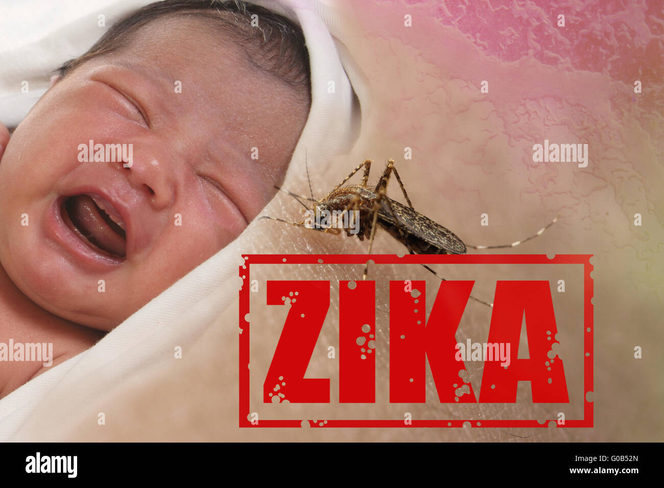 Health issue concept, image of crying baby bitten by Aedes Aegypti mosquito as Zika Virus carrier Stock Photo