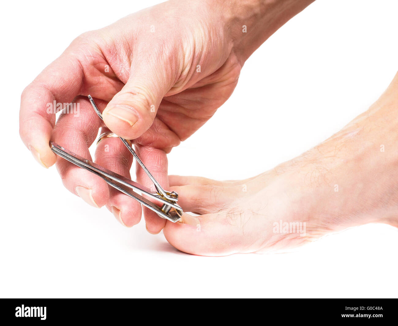 Person cutting ingrown big toenail Stock Photo