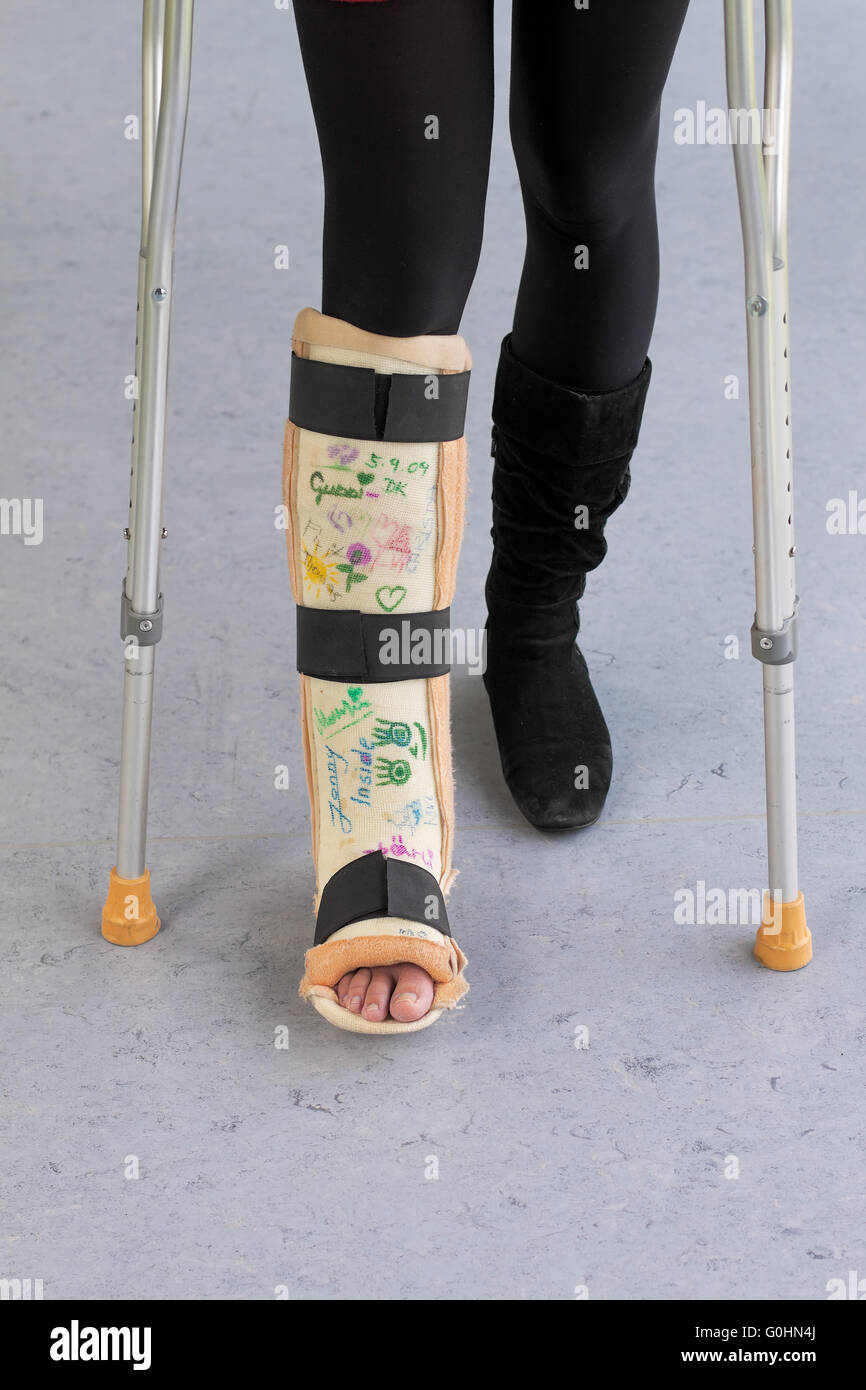 Woman with leg cast and crutches in hospital Stock Photo - Alamy