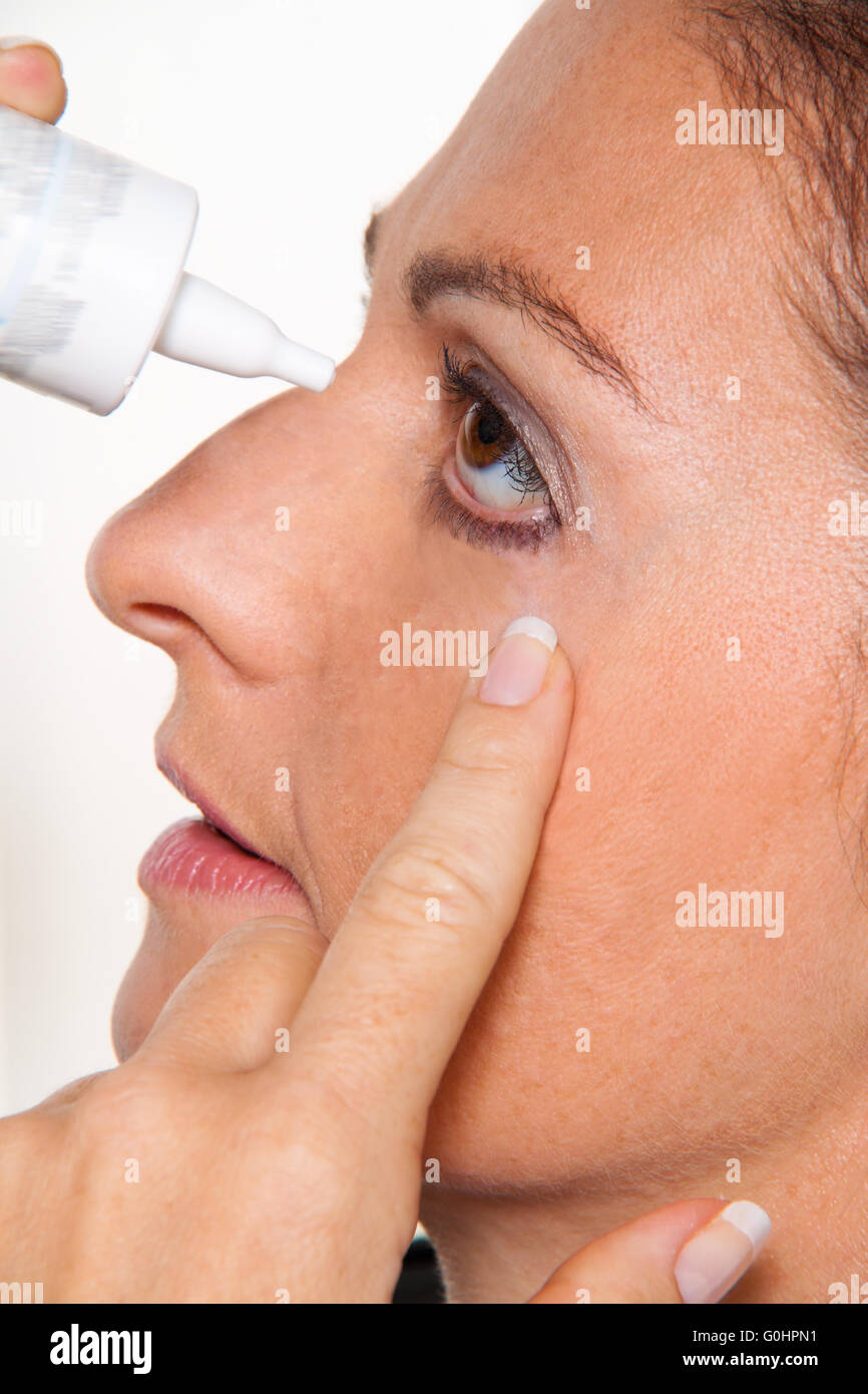 Woman with allergies and eye drops. Hay fever Stock Photo