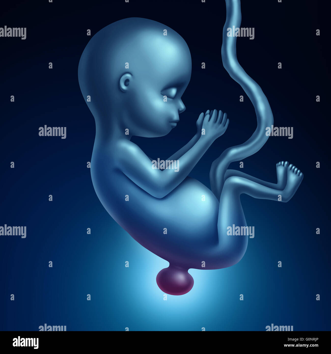 Spina bifida birth defect medical concept as a malformation in the anatomy of a fetus with swelling in the lower spinal area as Stock Photo