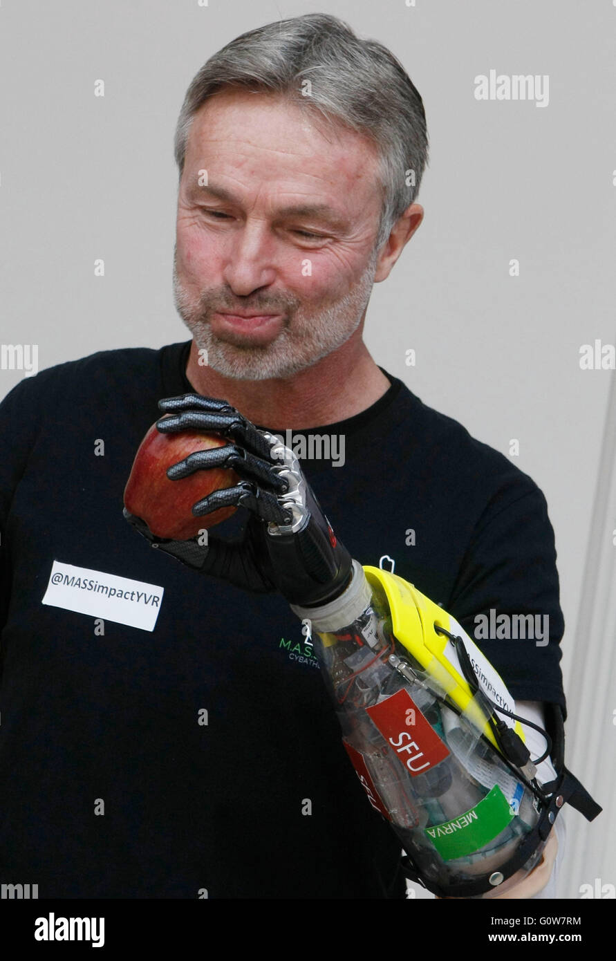 Vancouver, Canada. 3rd May, 2016. Paralympic skier Danny Letain eats an apple with his bionic hand at Simon Fraser University in Vancouver, Canada, May 3, 2016. Researchers from Simon Fraser University (SFU) developed a new robotic prosthesis with an armband of pressure sensors that track movements of the muscles to carry out intuitive actions. © Liang Sen/Xinhua/Alamy Live News Stock Photo
