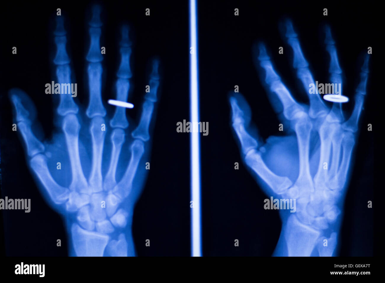 Share 125+ mechanic wedding ring accident best awesomeenglish.edu.vn