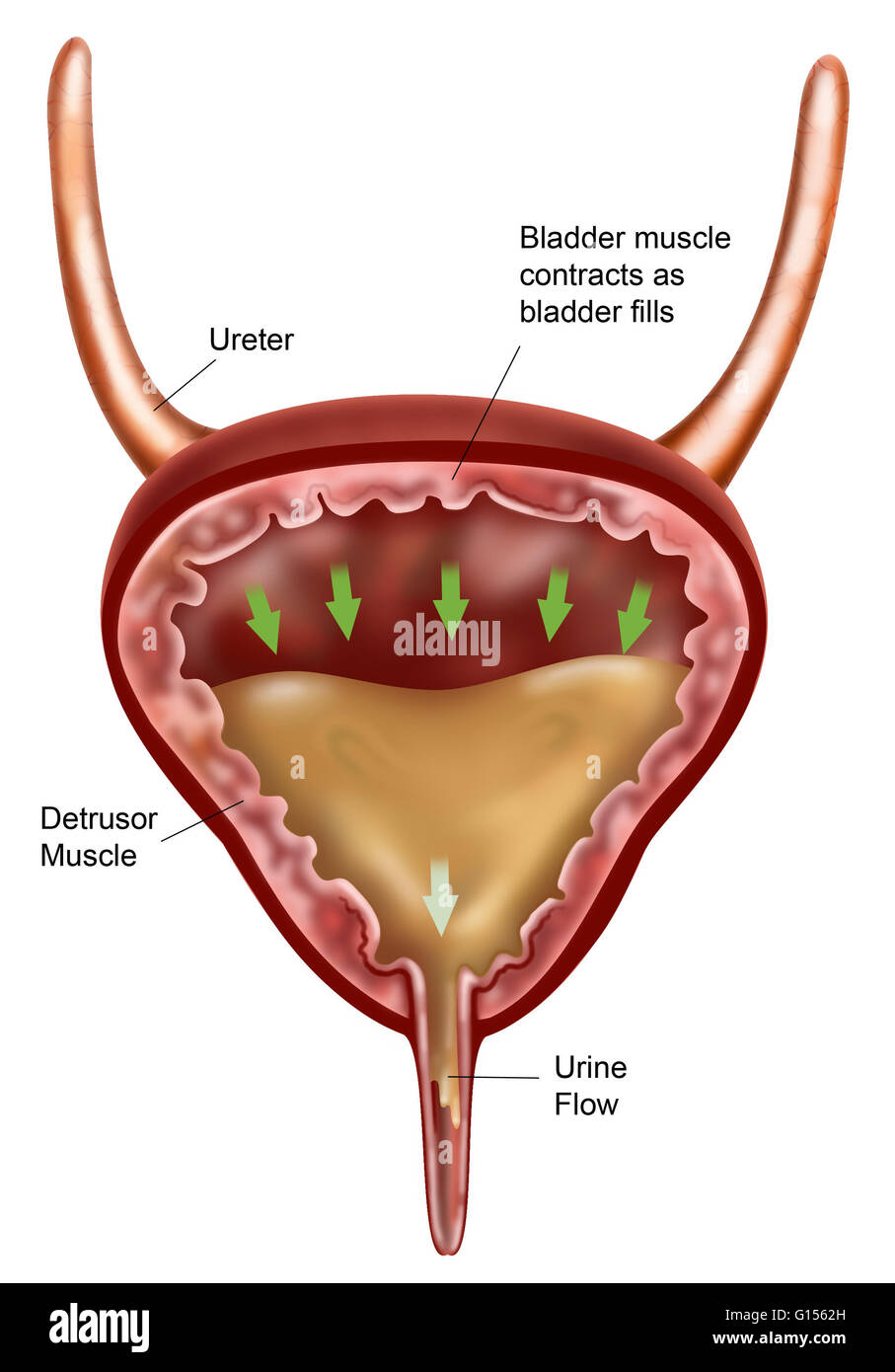 Illustration of a bladder filling with urine as the bladder fills the