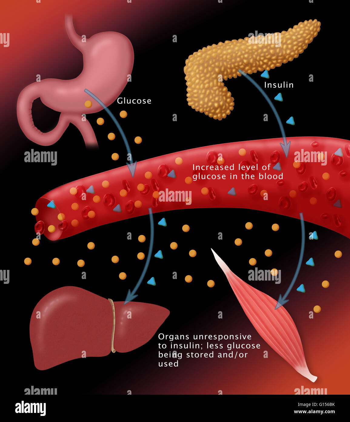 Illustration of insulin and glucose production in Type 2 diabetes Stock