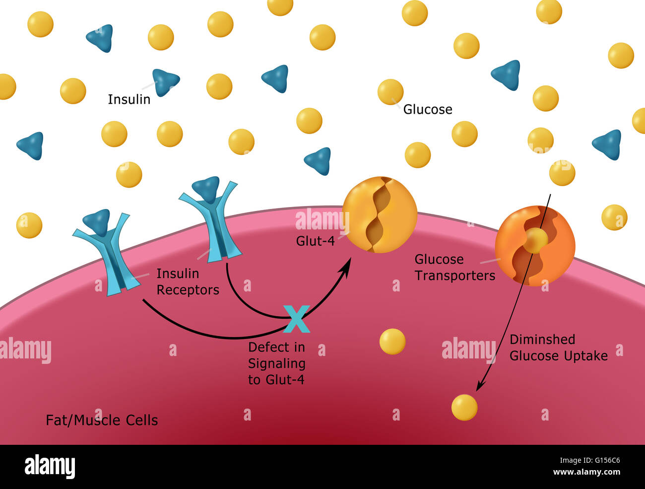 Illustration Of Insulin And Glucose Production In Type 2 Diabetes. Insulin  (Blue Triangles) Is Produced By Islet Cells In The Pancreas, And Acts In  Unison With Glucose (Yellow Dots) To Regulate Energy