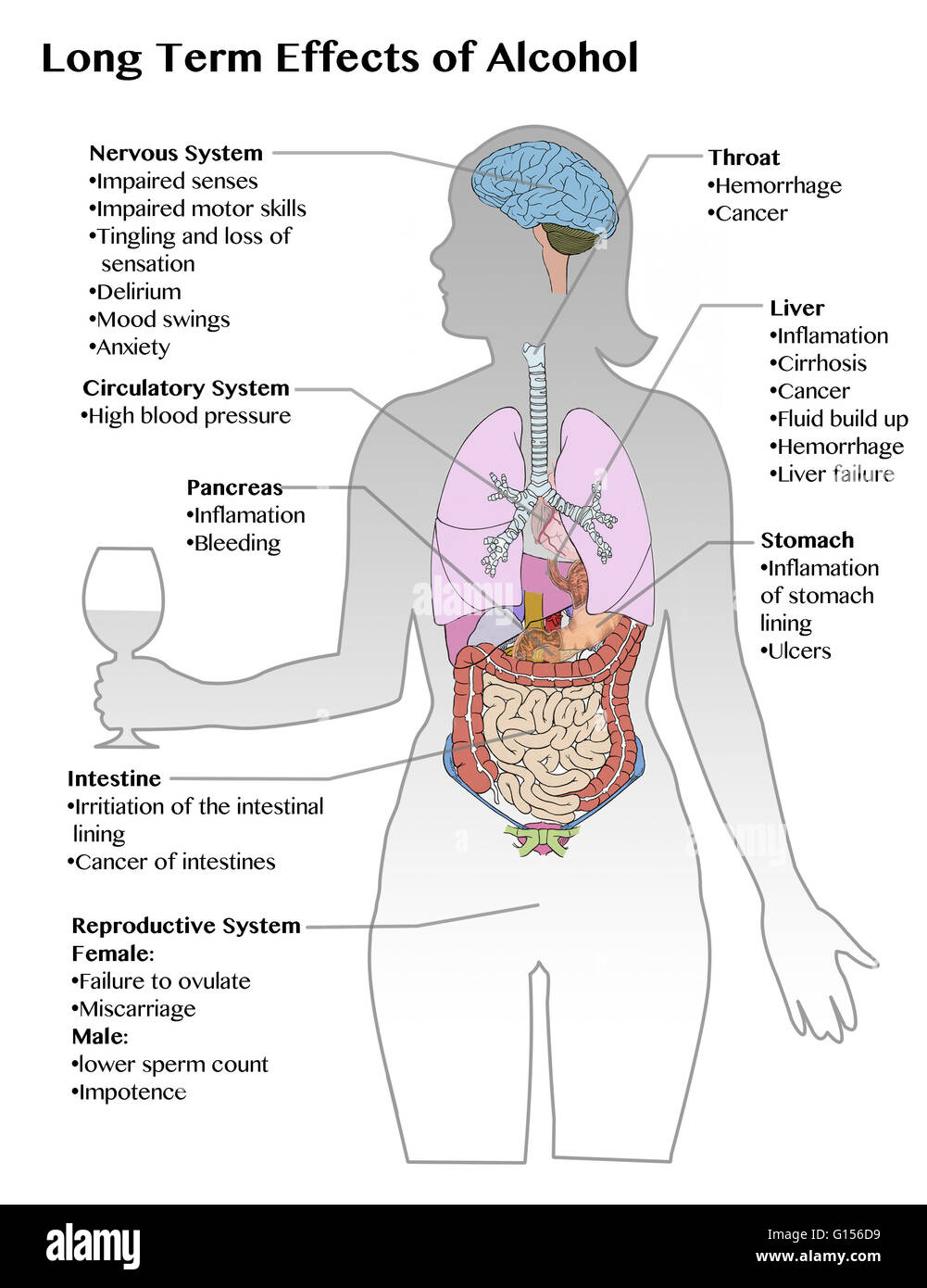 Diagram showing the longterm effects of excess alcohol consumption Stock Photo Alamy