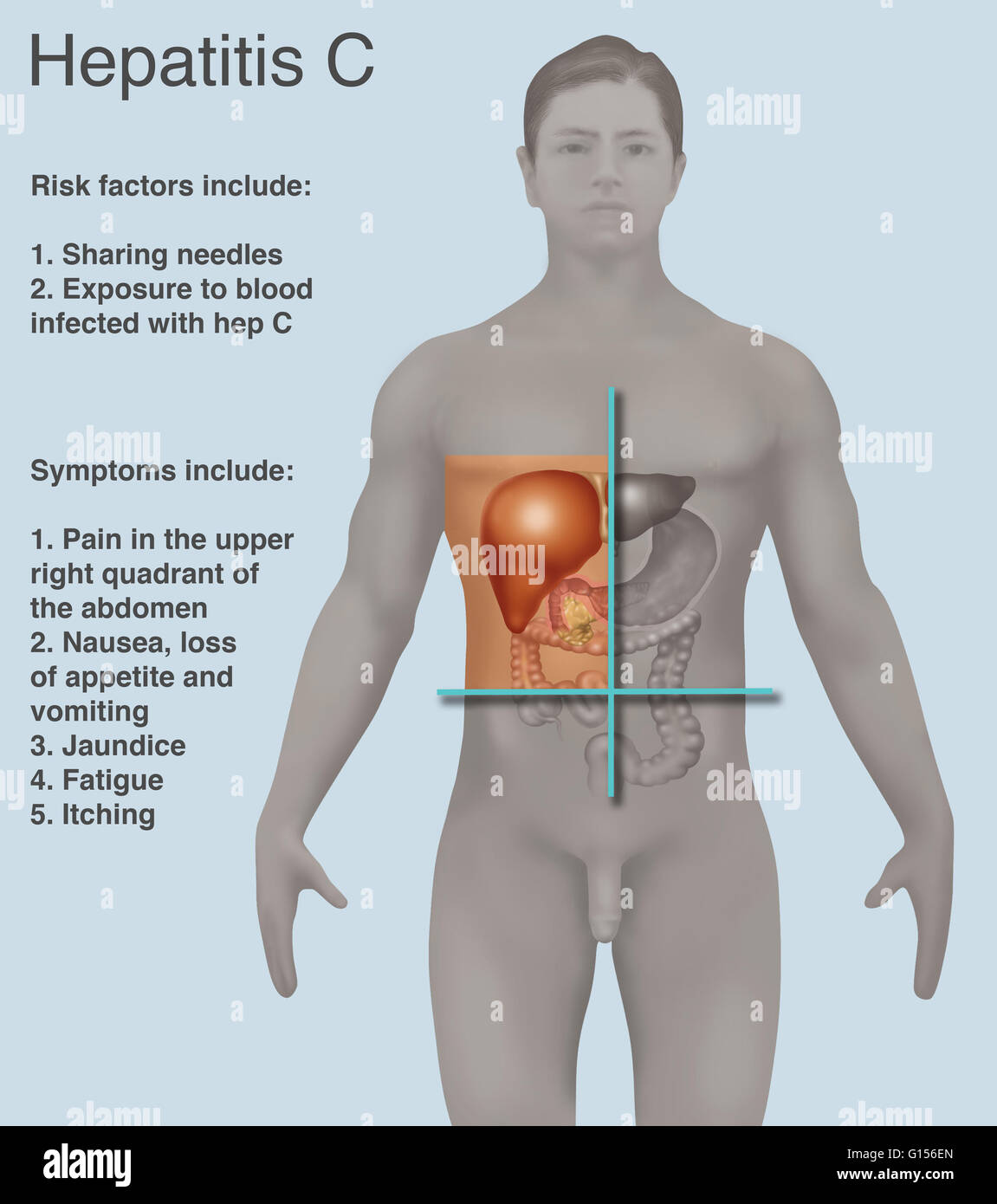 Right upper quadrant: Anatomy, organs and causes of pain