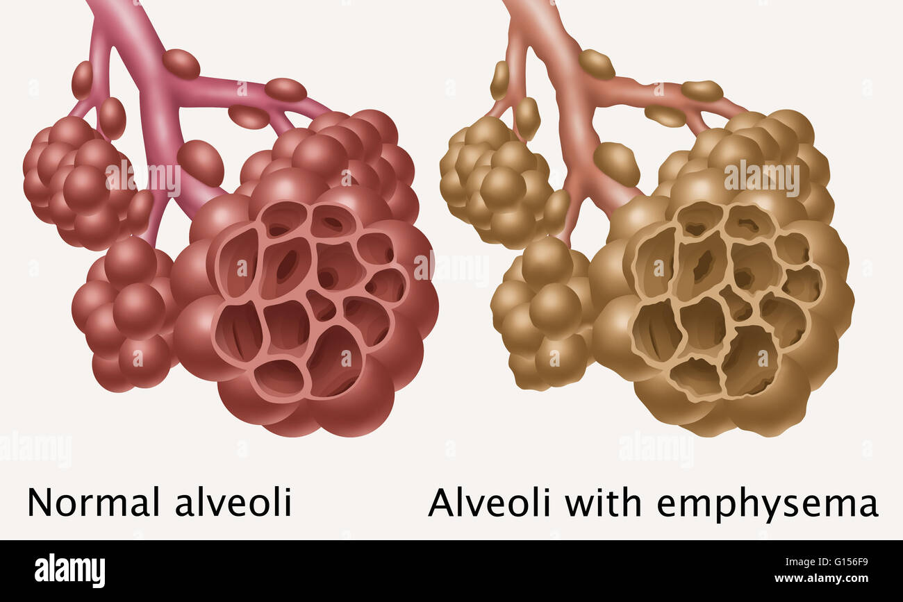 Alveoli Cross Section A Kyu Design Vrogue Co