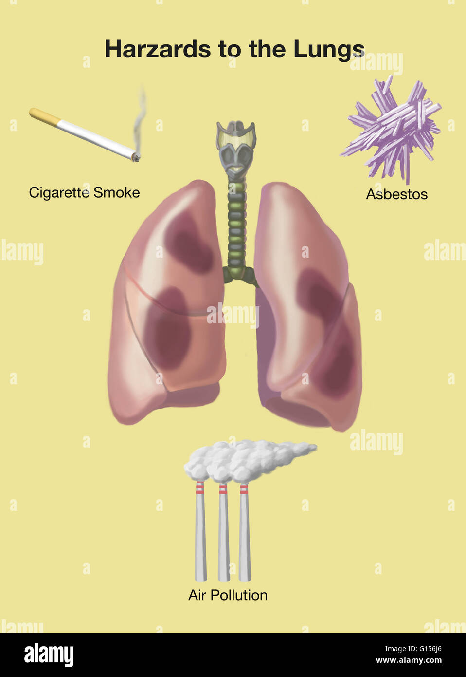 Illustration showing three different hazards to the lungs cigarette