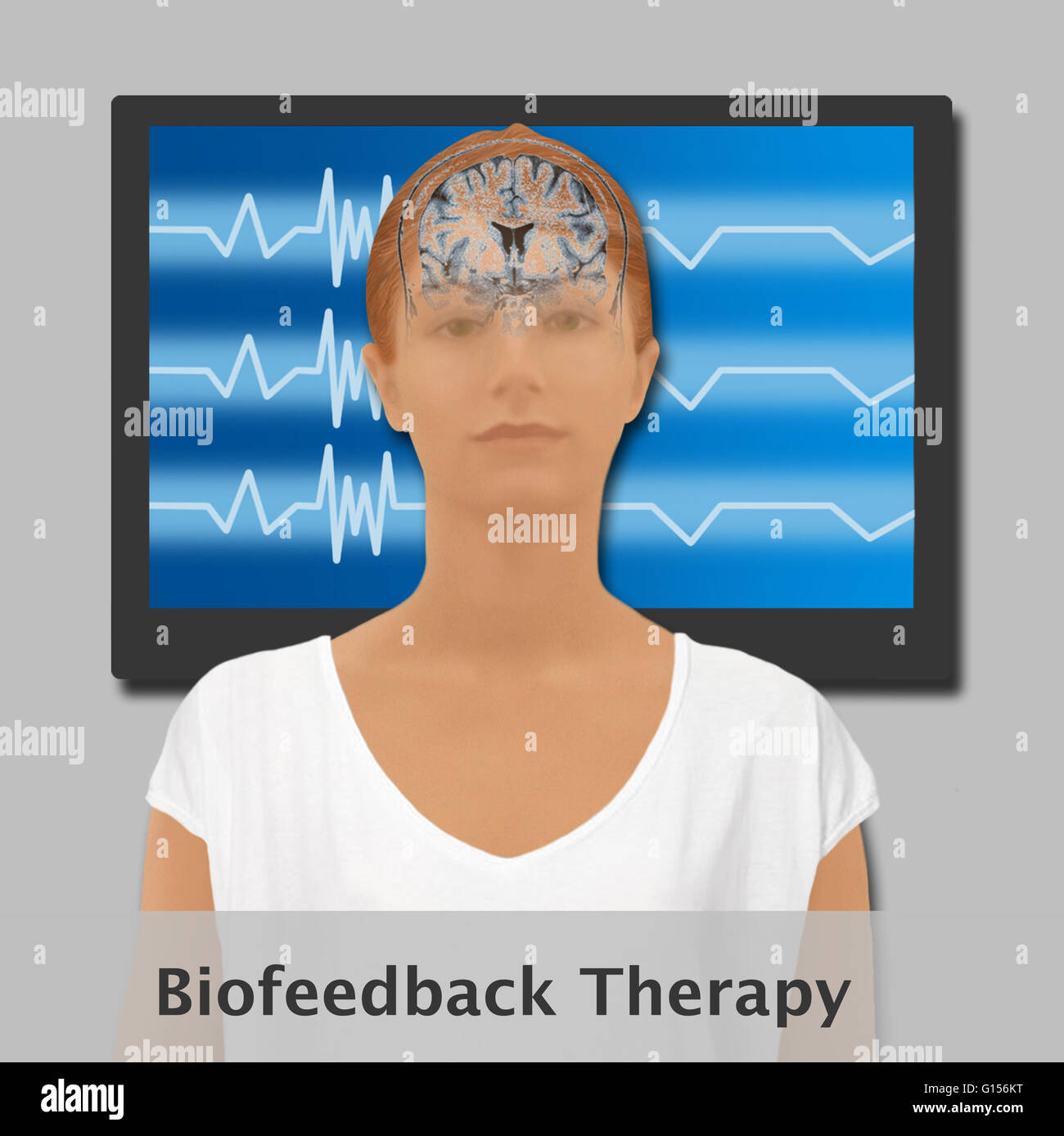 Illustration Of Biofeedback Therapy. Biofeedback Is Sometimes Used To ...