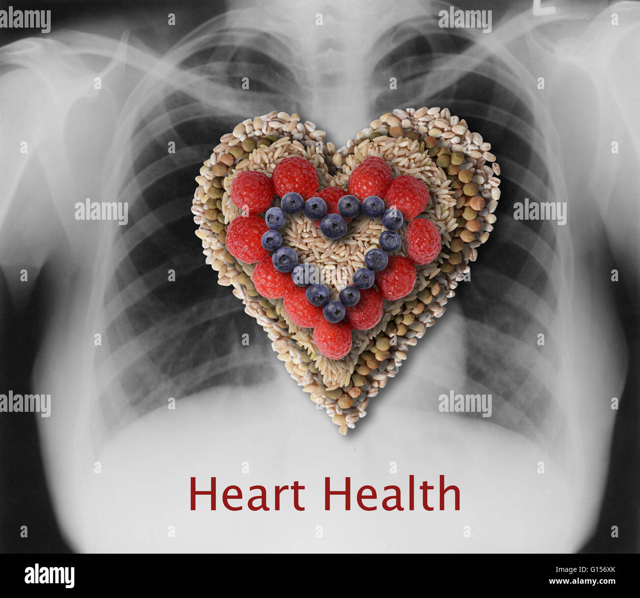 Conceptual image of heart-healthy foods in the shape of a heart over a x-ray of a healthy heart and lungs. Four heart-healthy foods, from bottom to top: barley, lentils, brown rice, raspberries, blueberries. Stock Photo