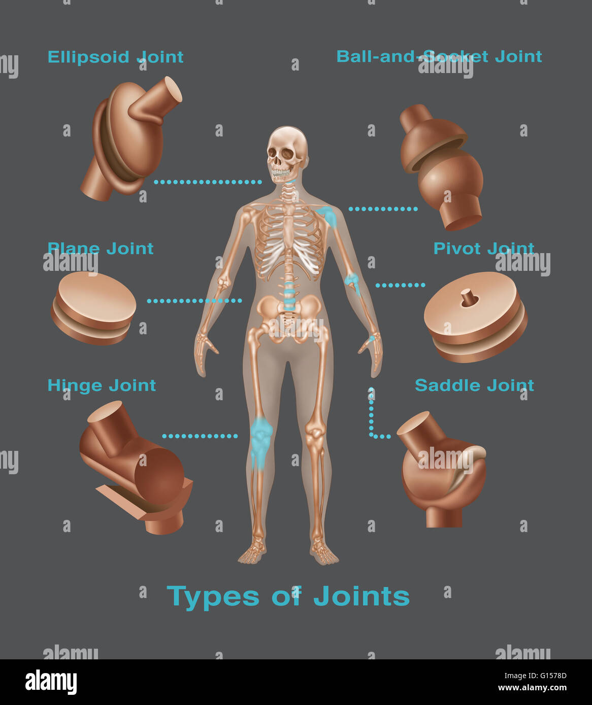 Joint replacements in the human body. Types of joint replacements  include ball and socket joint, pivot joint, saddle joint, hinge joint, plant joint and ellipsoid joint. Stock Photo