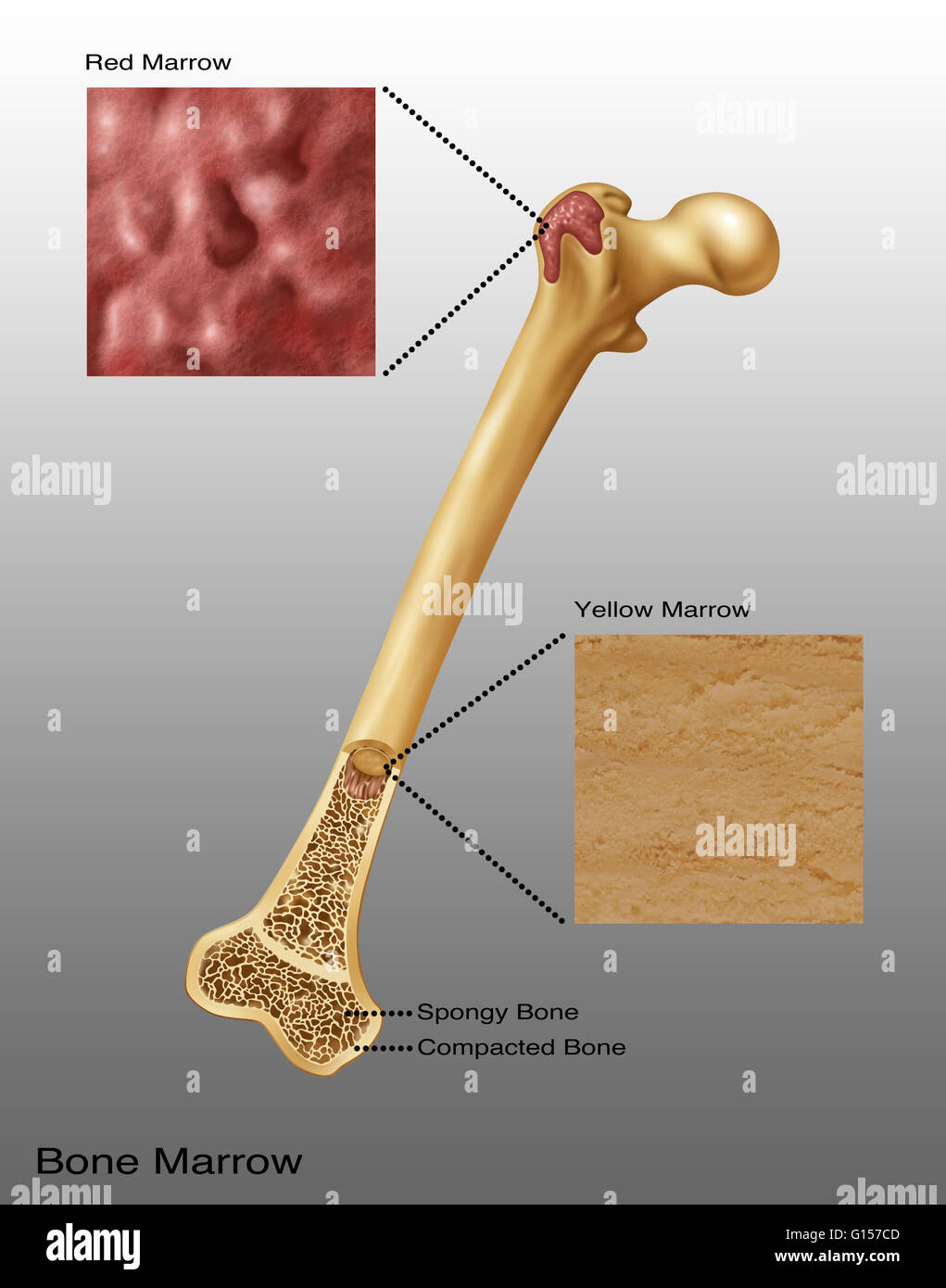 Illustration of bone marrow. Top diagram shows red bone marrow, Bottom  diagram shows yellow marrow. Spongy bone and compacted bone also visible  Stock Photo - Alamy