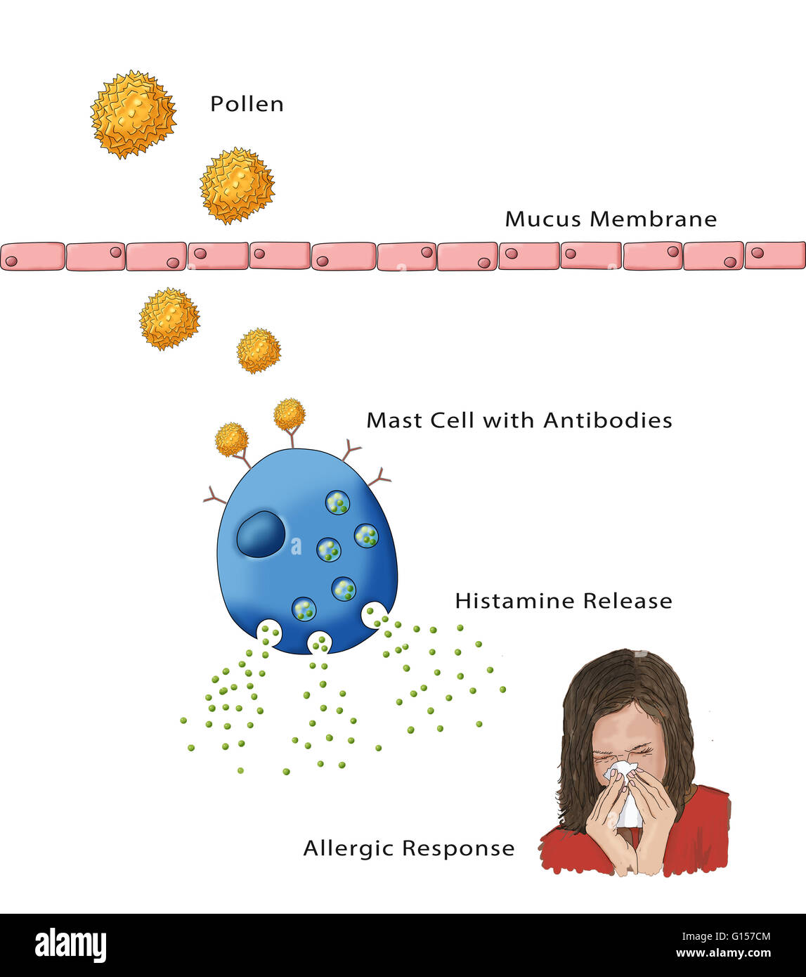 Illustration showing the process of an allergic response Stock Photo ...