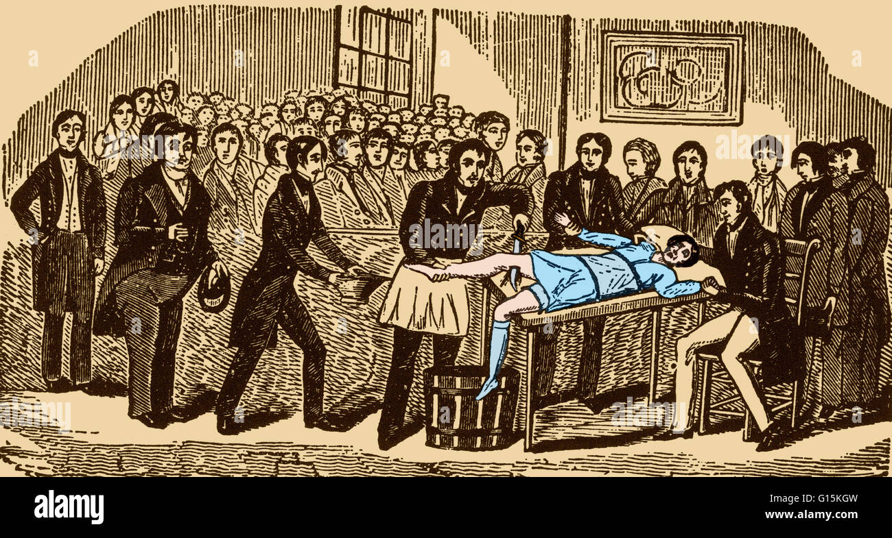 Before the advent of anesthesia, surgery was a traumatically painful