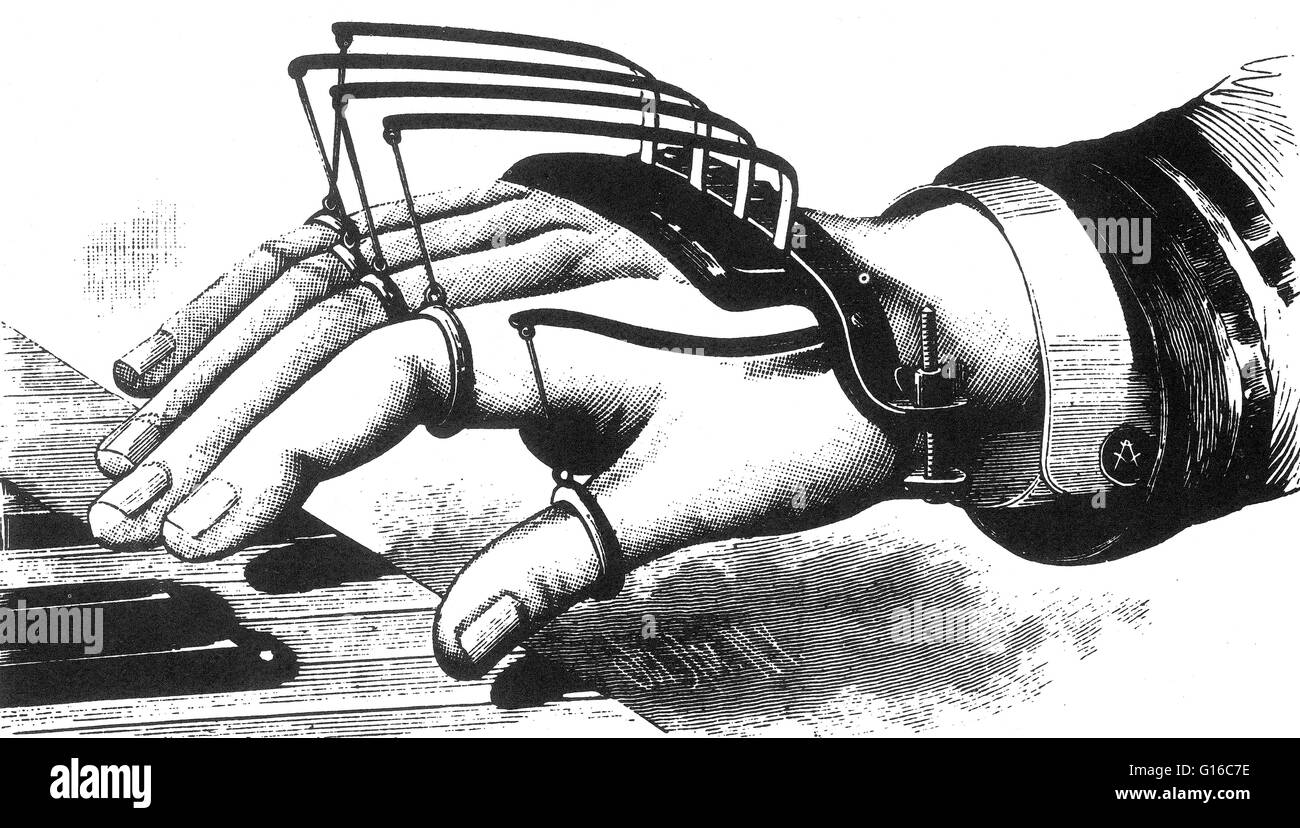 Atkins' finger-supporting device which appeared in the Scientific American in January 1881. In 1881 Benjamin Atkins patented this 'new and useful device for supporting and exercising the fingers of players on keyboard instruments.' Essentially it's a seri Stock Photo