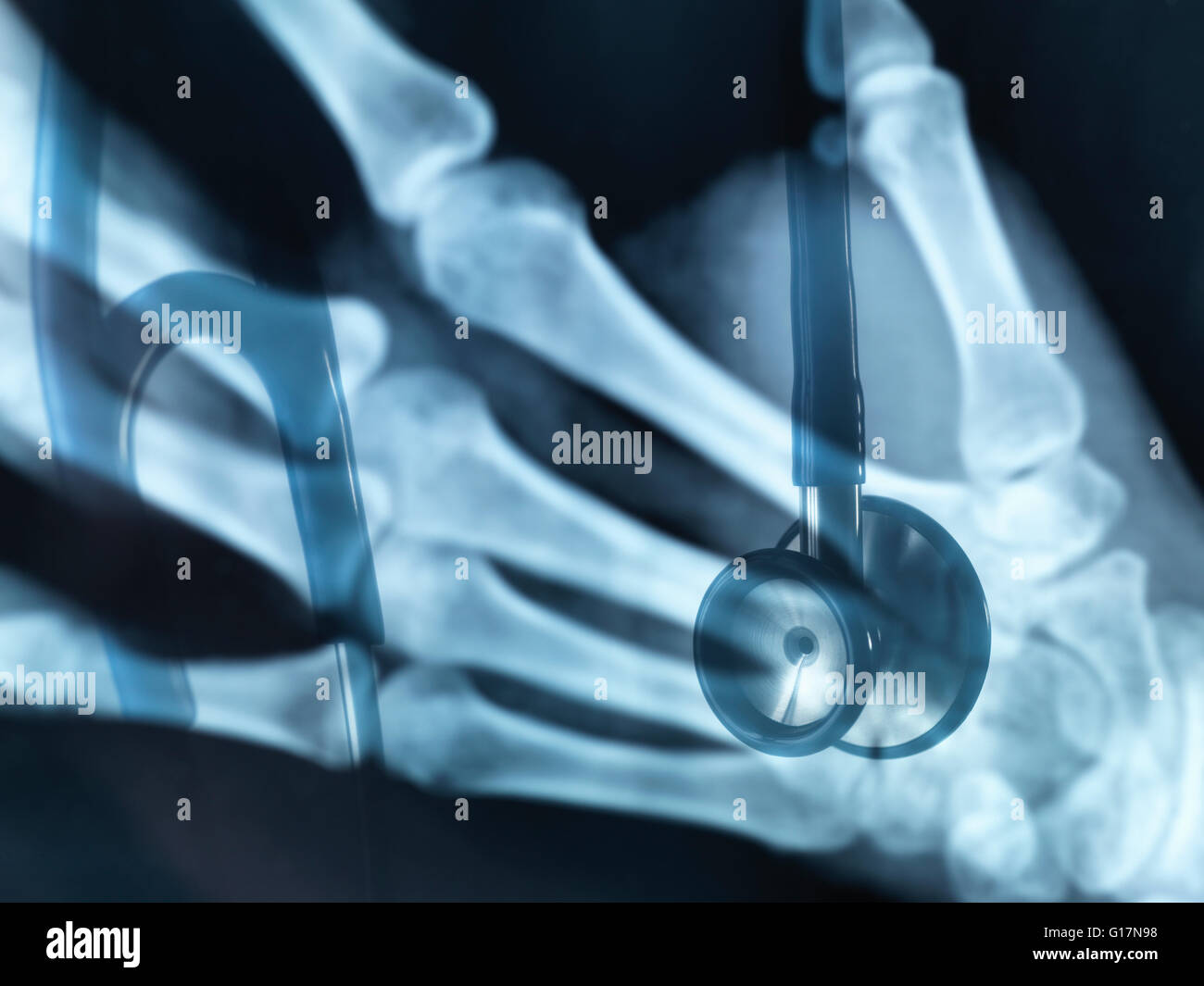 A view of a stethoscope through an x-ray Stock Photo
