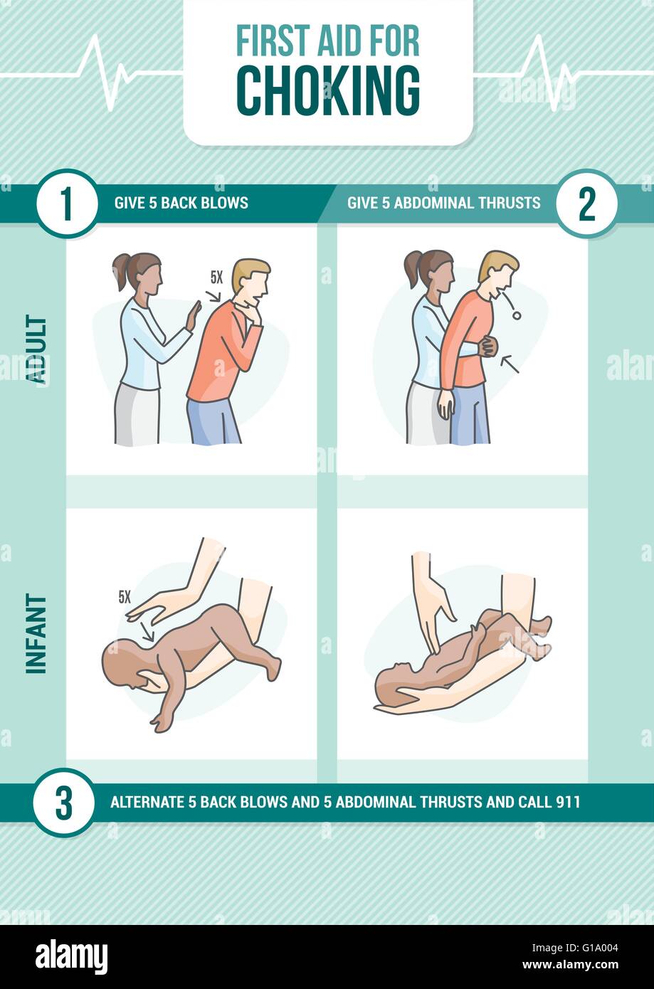 First aid procedure for choking and heimlich maneuver for adults and  infants Stock Vector Image & Art - Alamy