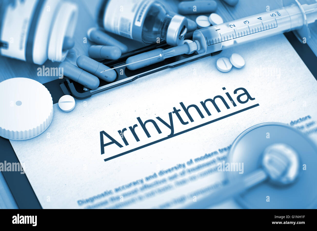 Arrhythmia Diagnosis. Medical Concept. Stock Photo