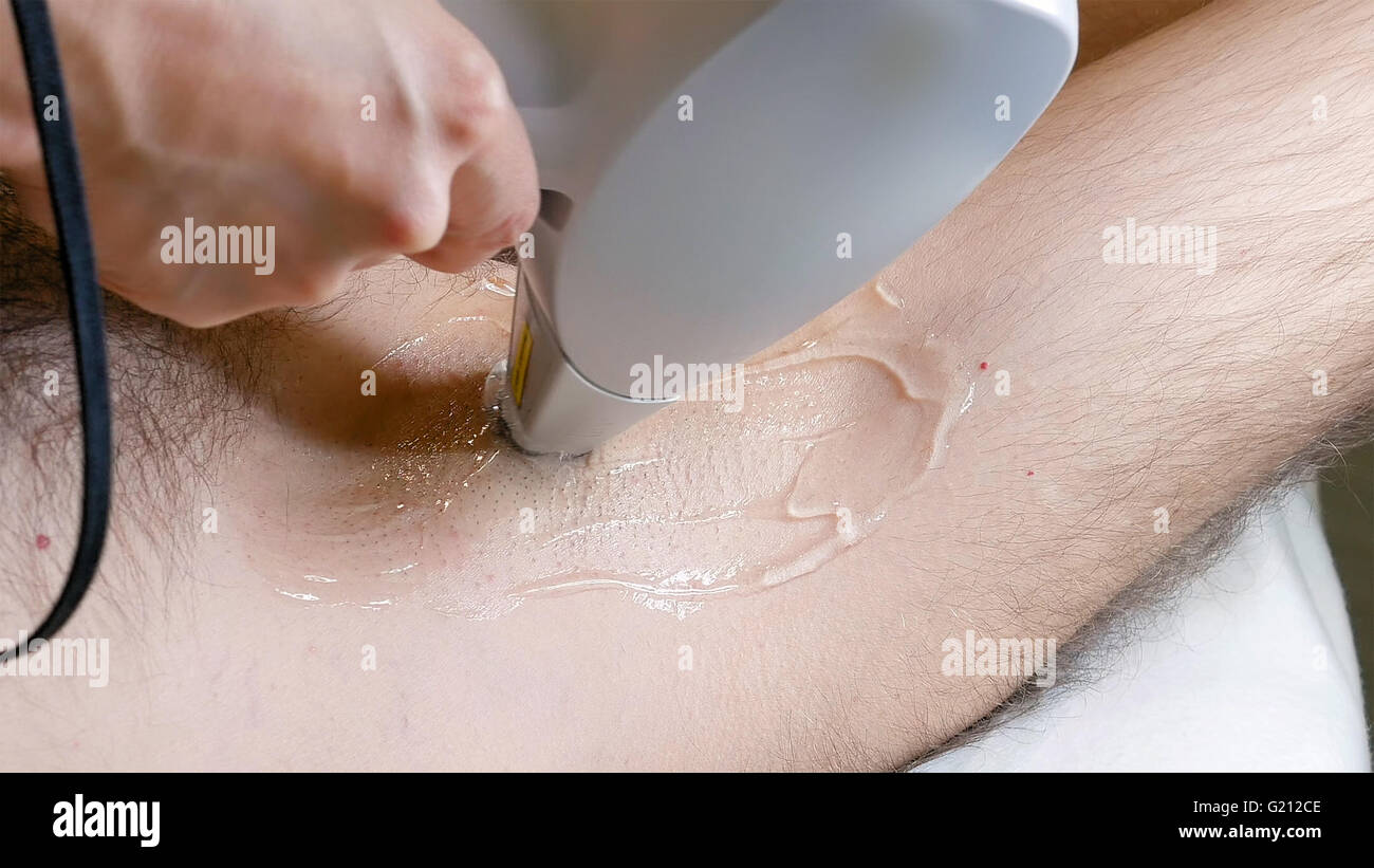 Man Gets Laser Hair Removal Treatment Underarm Stock Photo