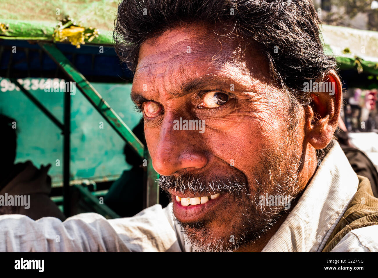 Man with one eye, Delhi, India Stock Photo