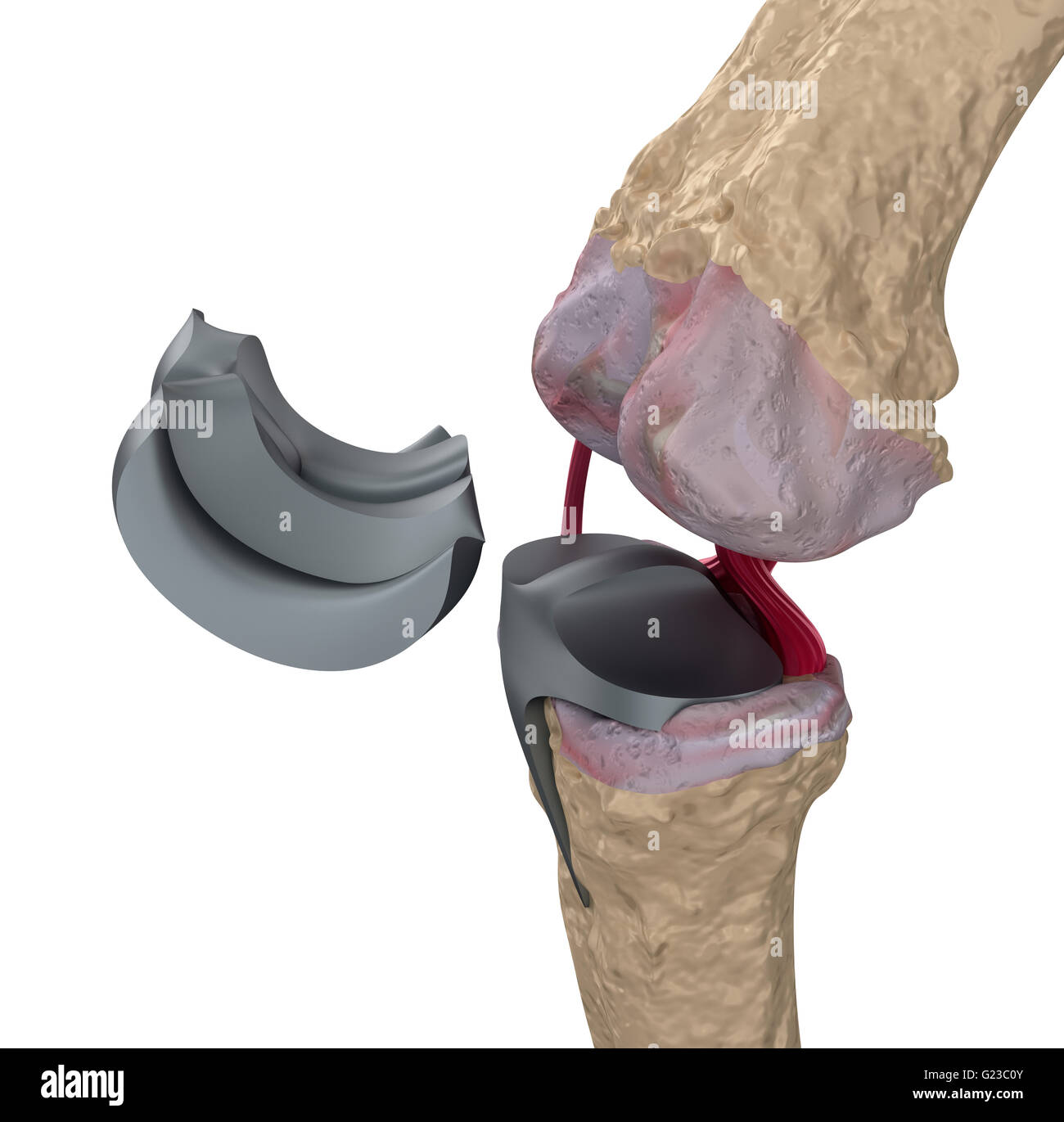 Knee and titanium hinge joint. Isolated on white Stock Photo Alamy