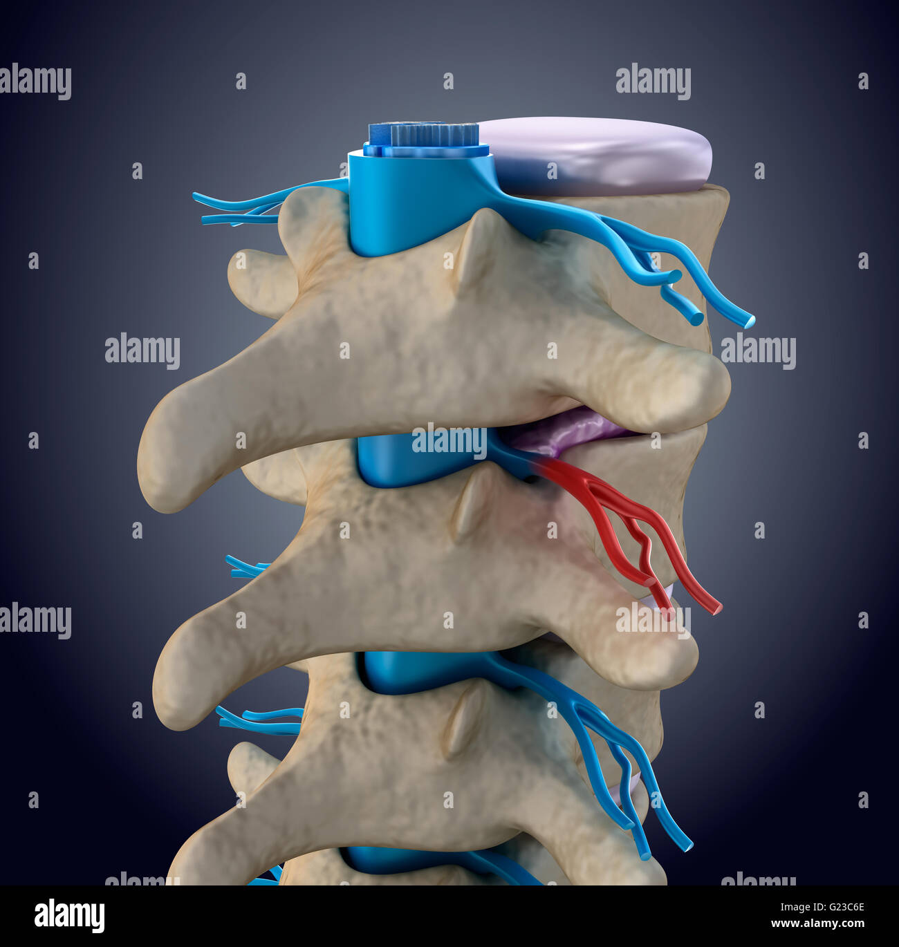 My Image 22