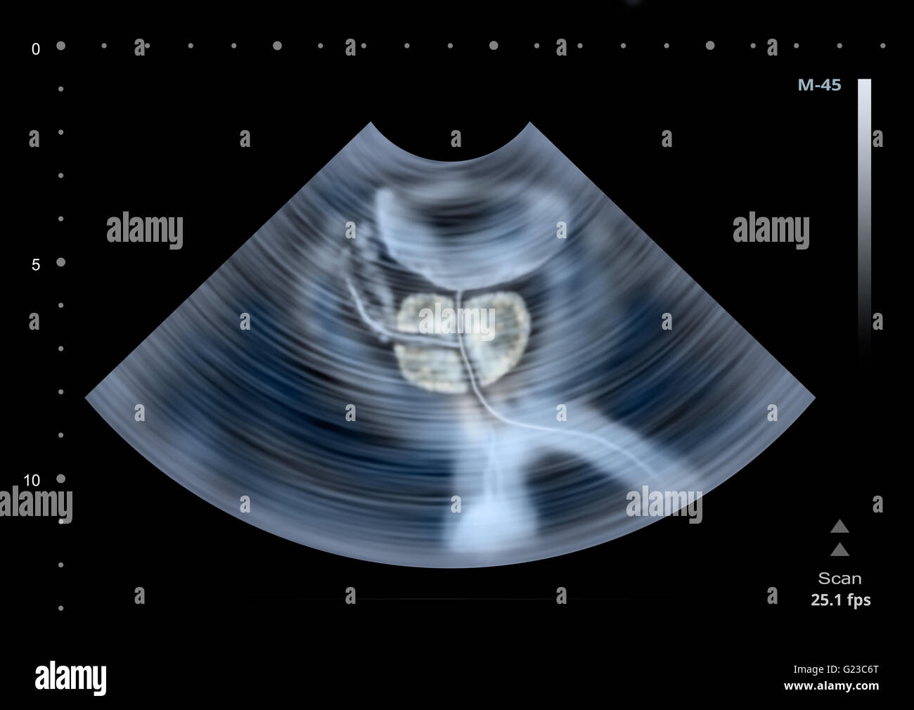 Ultrasound scan of human Prostate. Illustration Stock Photo