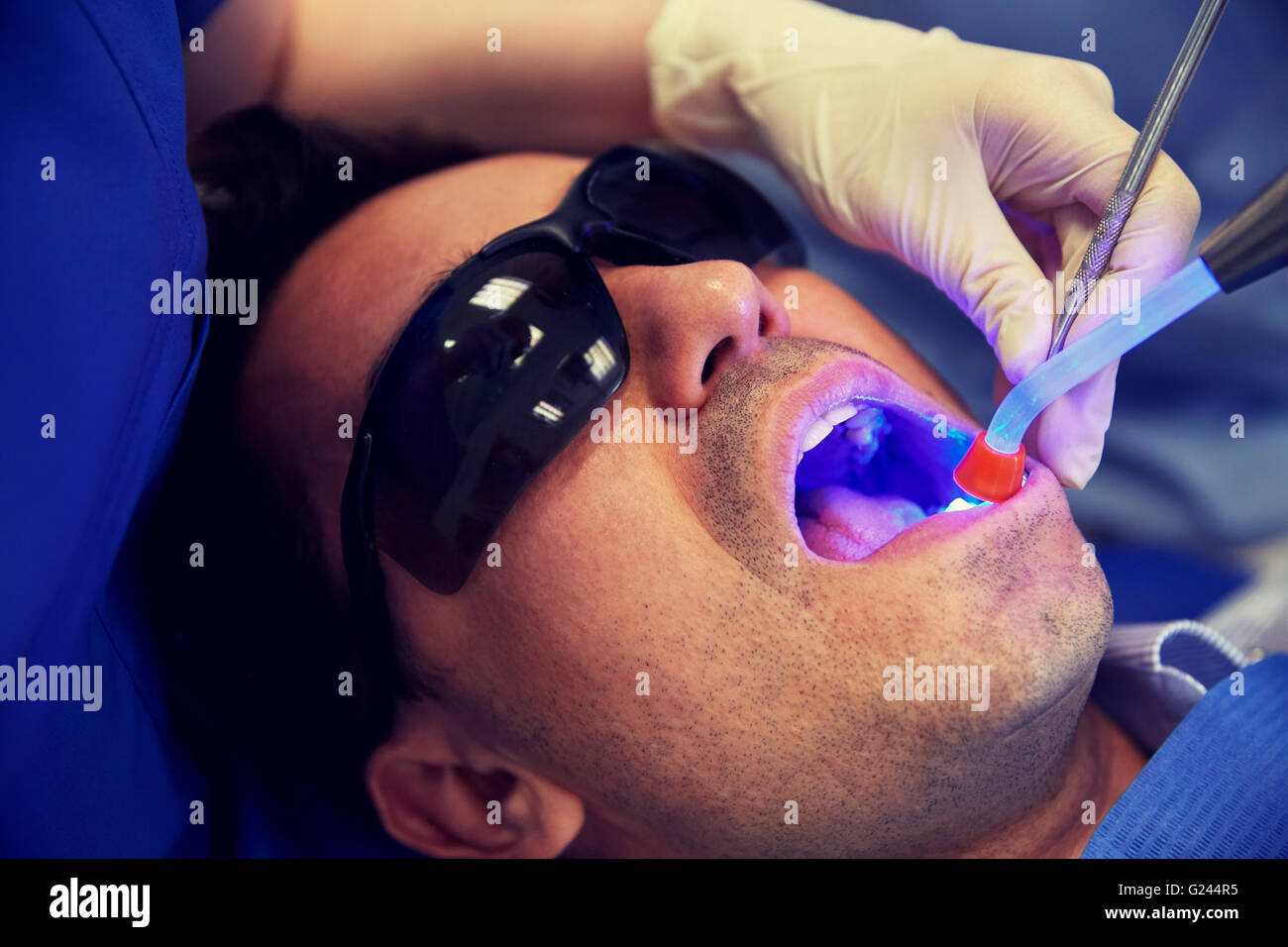 close up of male patient with dental curing light Stock Photo Alamy