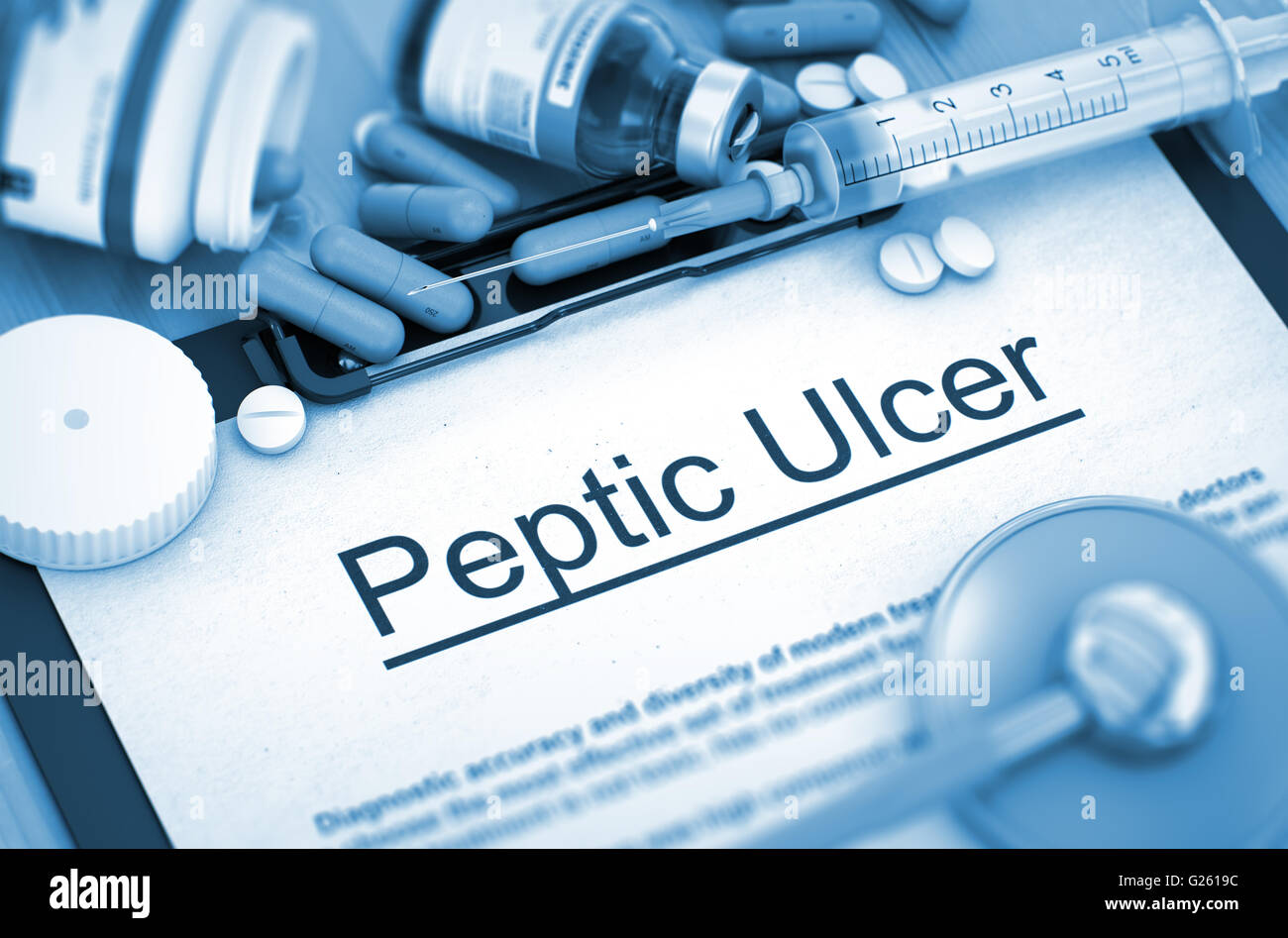 Peptic Ulcer Diagnosis. Medical Concept. Stock Photo
