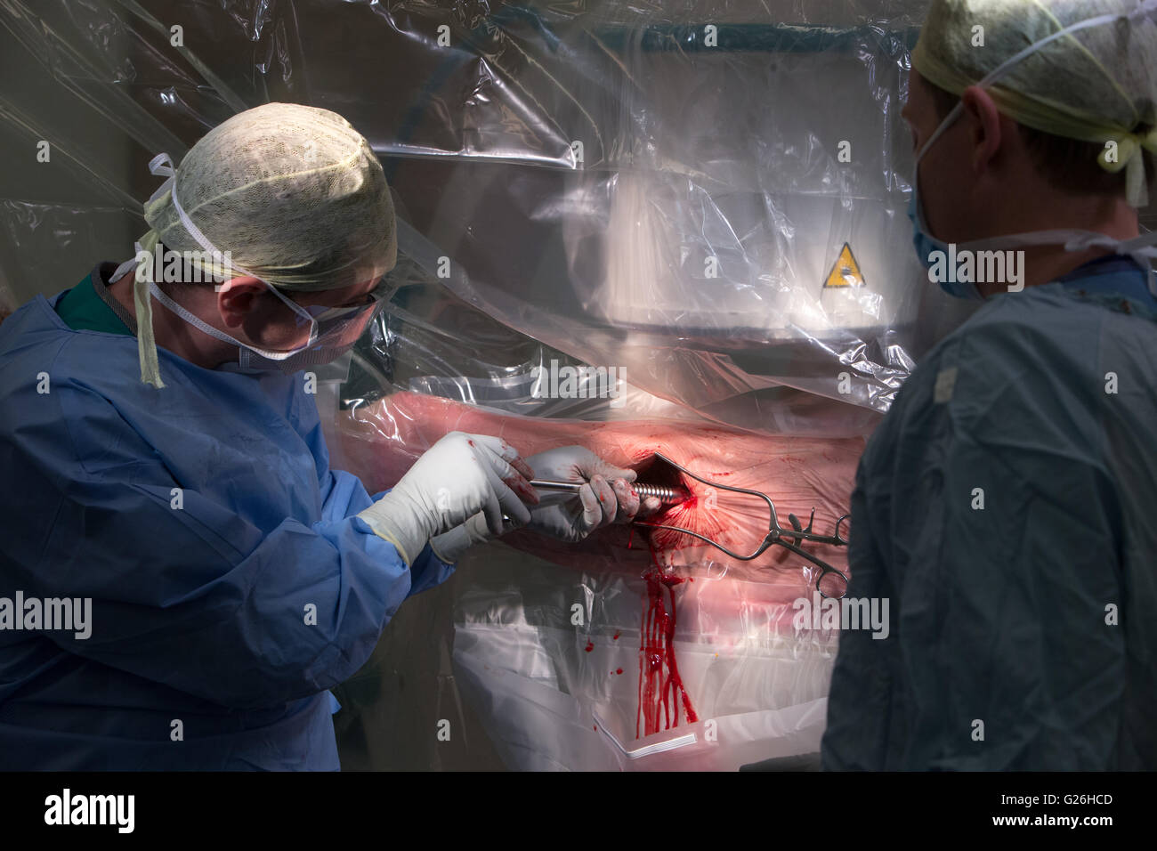 Surgeon in the theatre working on a left decompression hip screw operation.Close uo of the operation. Stock Photo