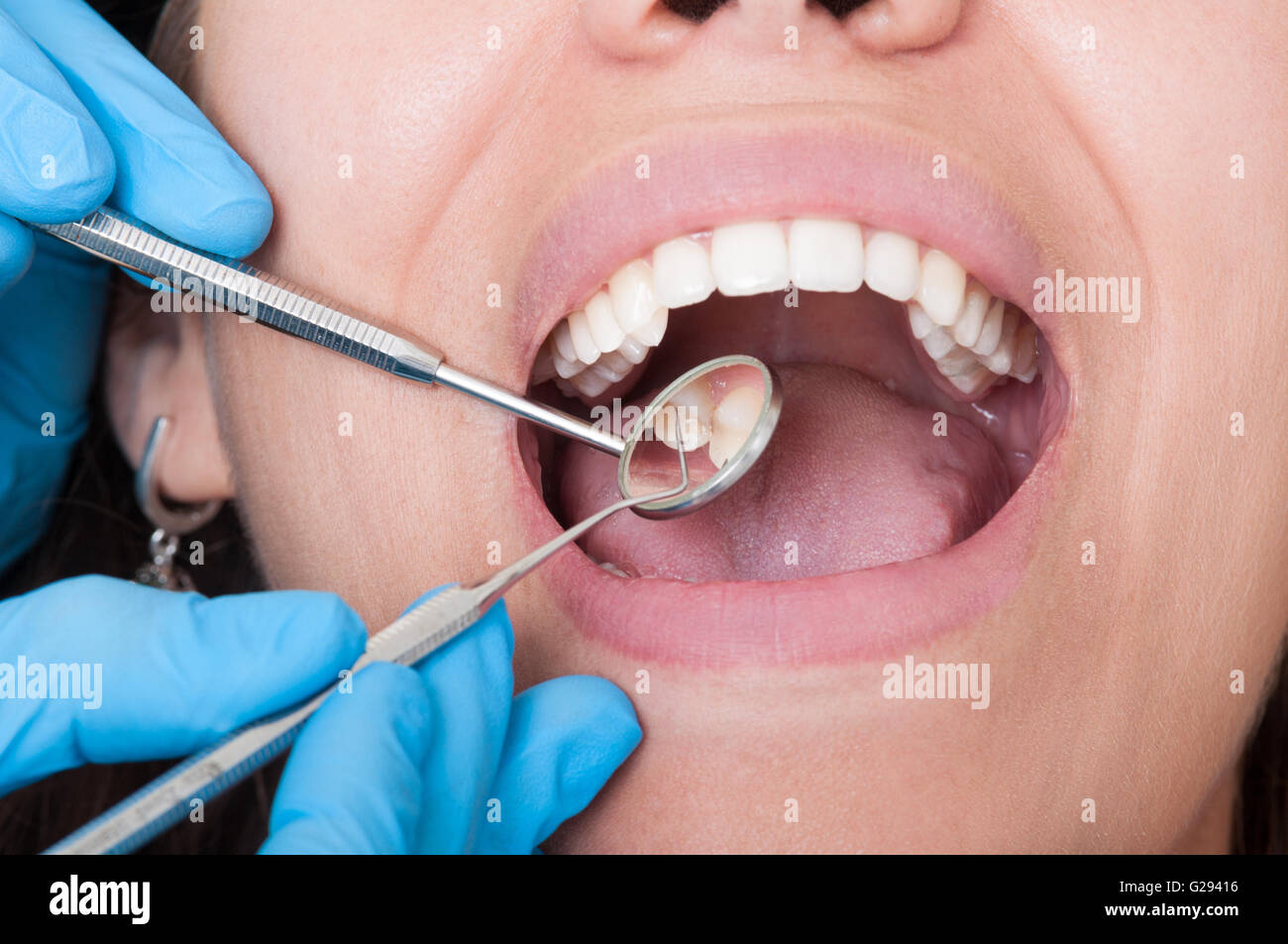 Closeup of dentist tools and mouth open with beautiful teeth Stock ...