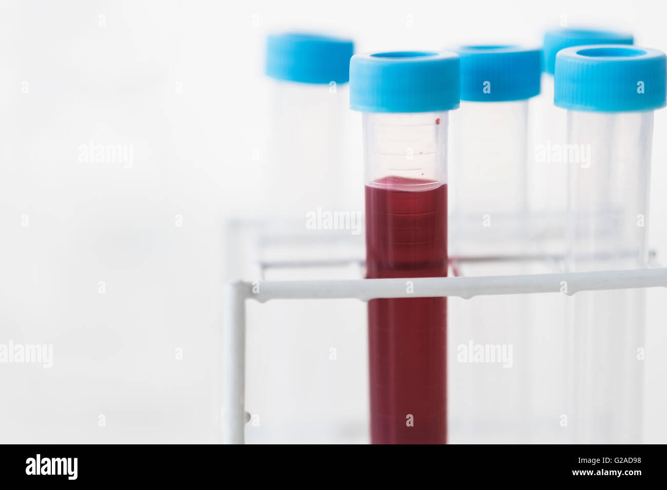 Blood sample in test tube Stock Photo Alamy