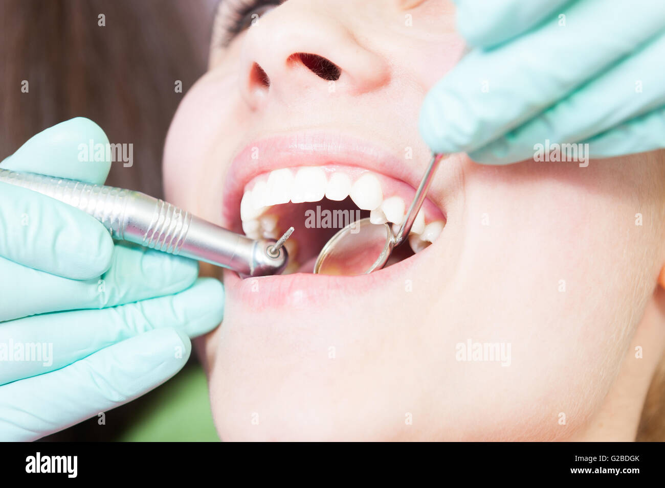 Drilling Cavity Stock Photos & Drilling Cavity Stock Images Alamy