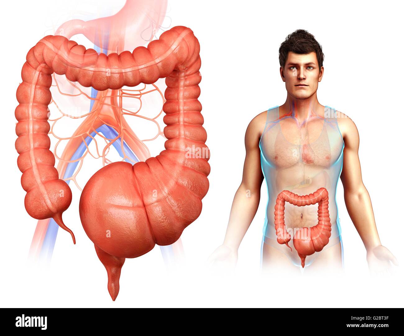 Illustration Mega Colon Cut Out Stock Images Pictures Alamy illustration-mega-colon-cut-out-stock-images-pictures-alamy