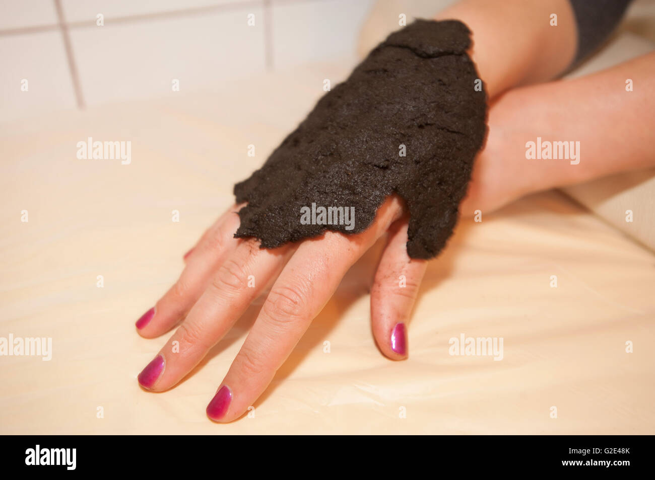 Slovenia Zrece Thermal Complex -Treatment with Peat Stock Photo