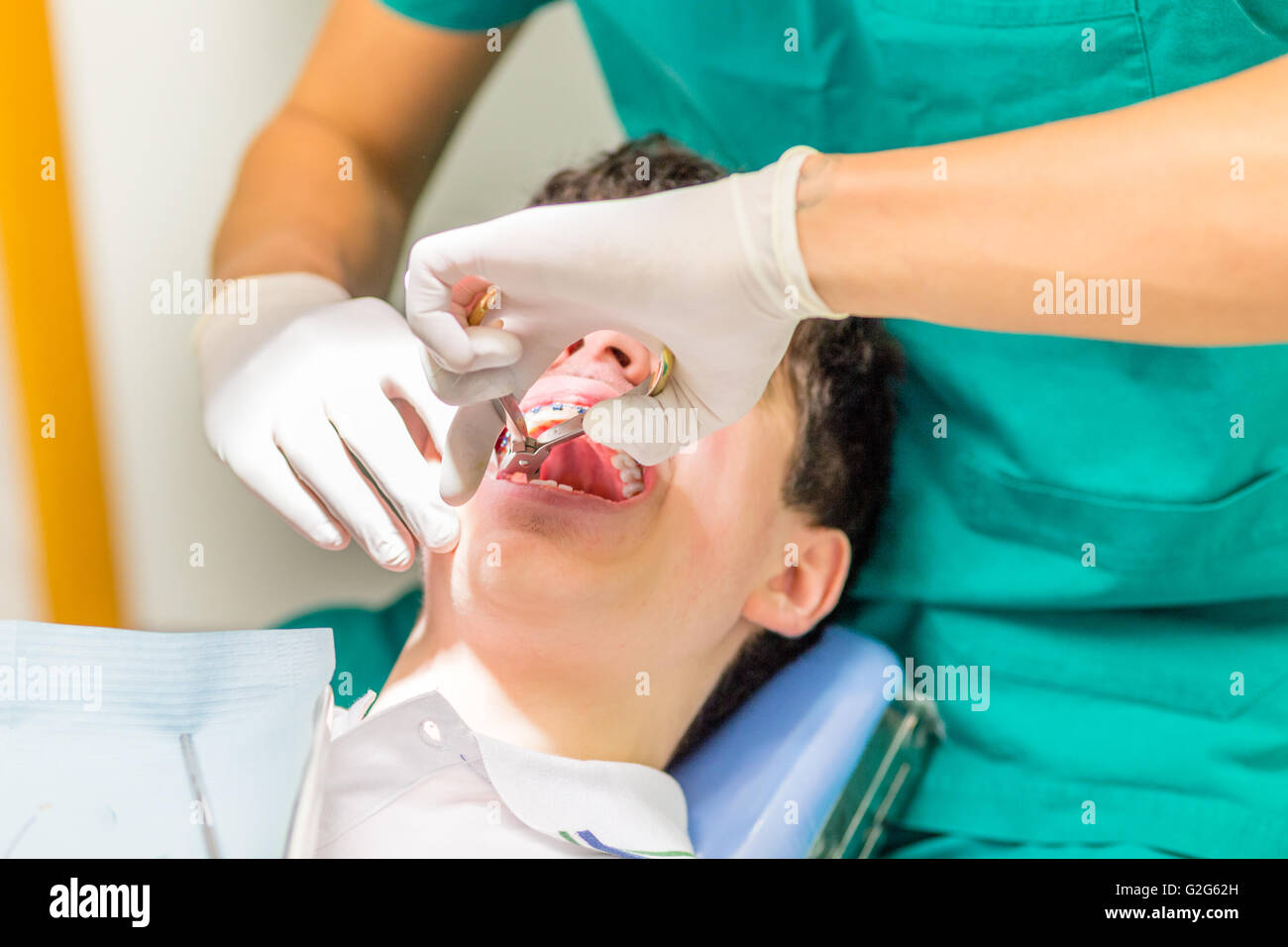 Dentist pulling tooth hires stock photography and images Alamy