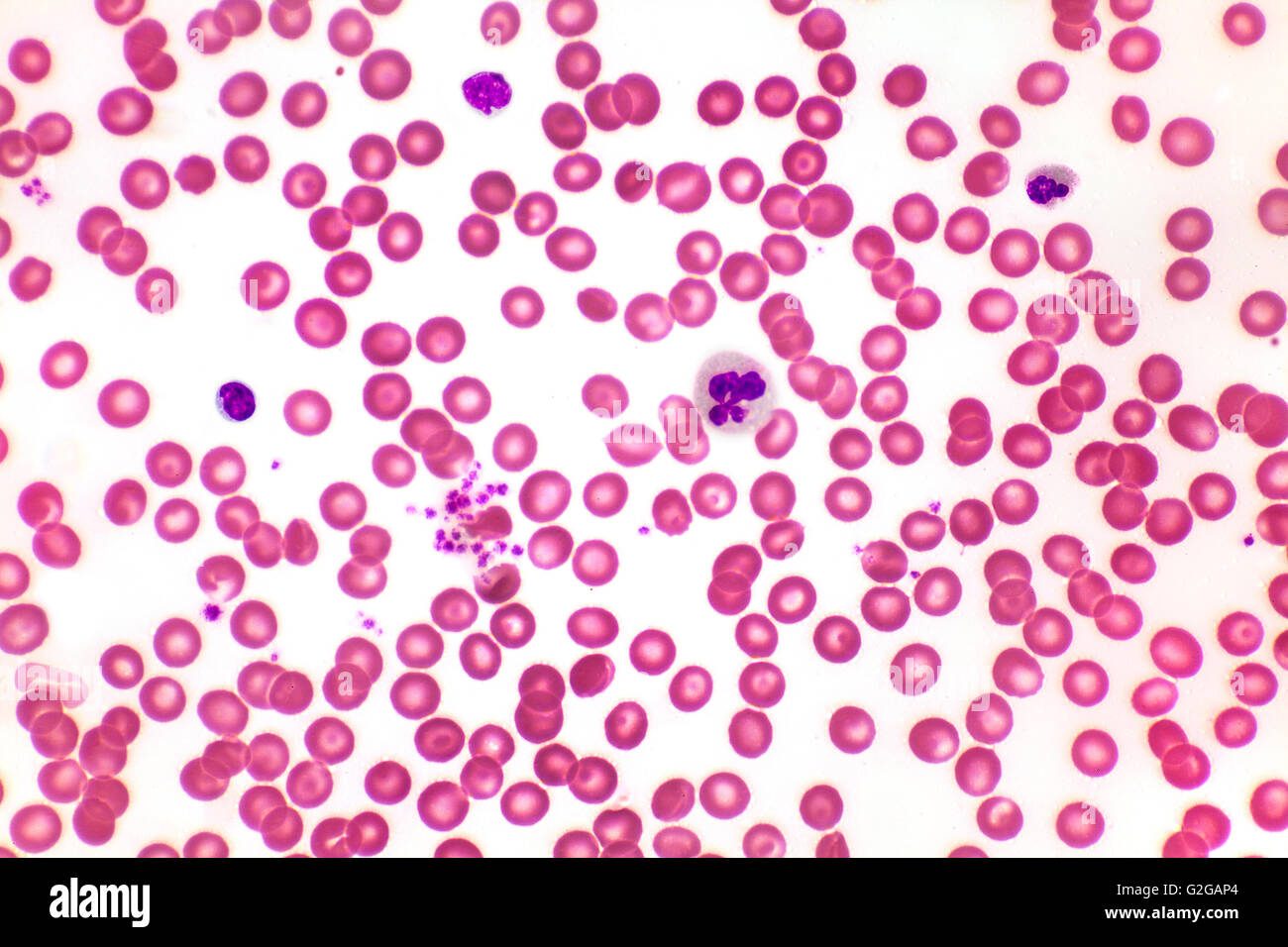 Healthy human red & white blood cells, brightfield photomicrograph Stock Photo