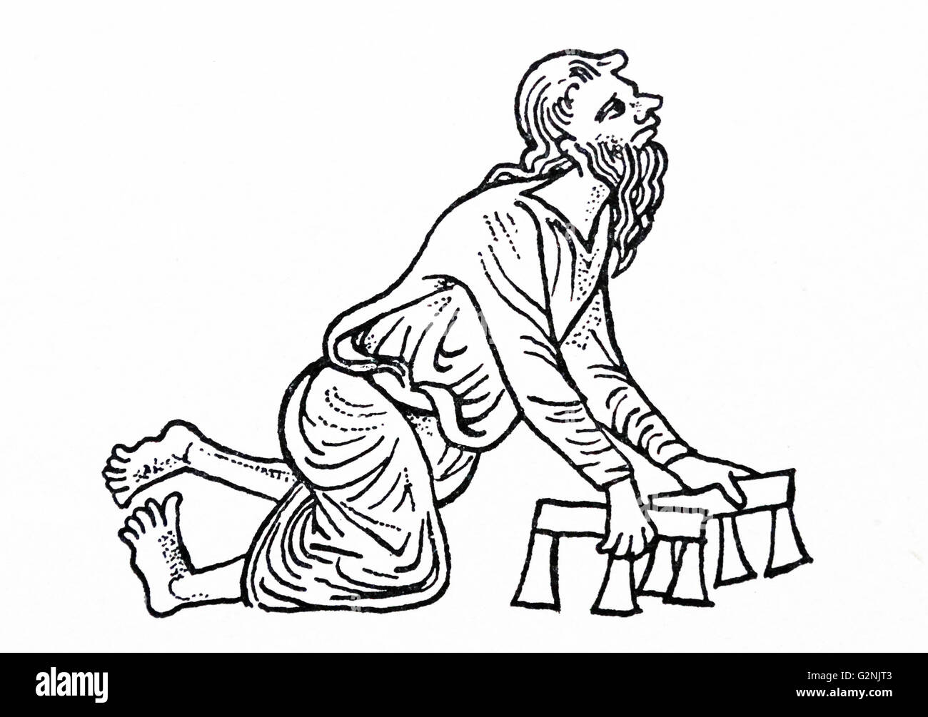Illustration of a man with a deformed foot and crude crutches. Dated 14th Century Stock Photo