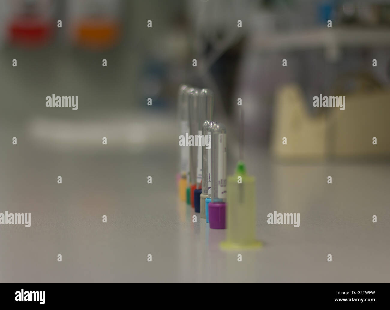Blood vials, tests, Pathology Stock Photo Alamy
