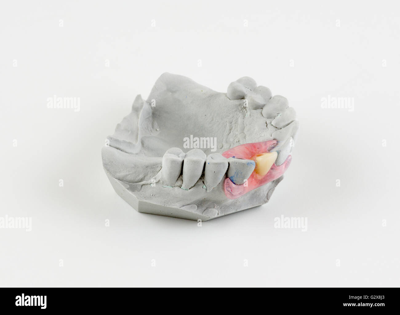 dentures made of nylon type of butterfly is made of one missing tooth Stock Photo
