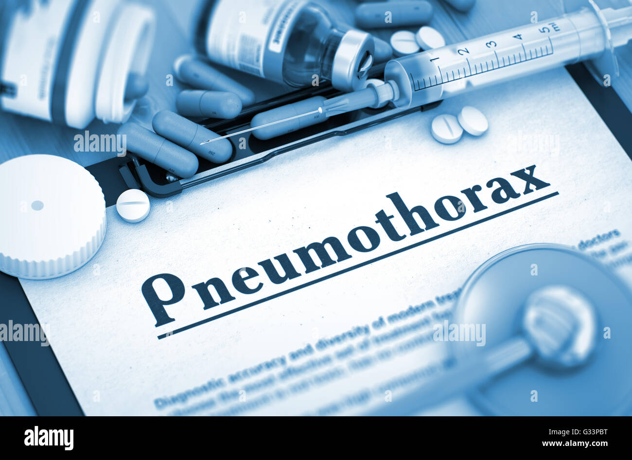 Pneumothorax Diagnosis. Medical Concept. Stock Photo