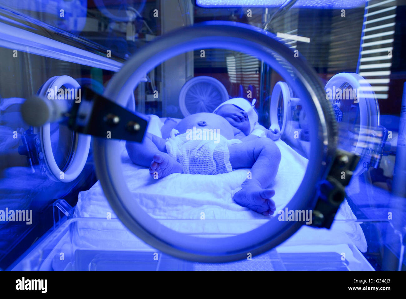 Newborn having a treatment for jaundice under ultraviolet light in