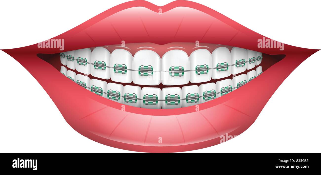 Mouth teeth diagram hires stock photography and images Alamy