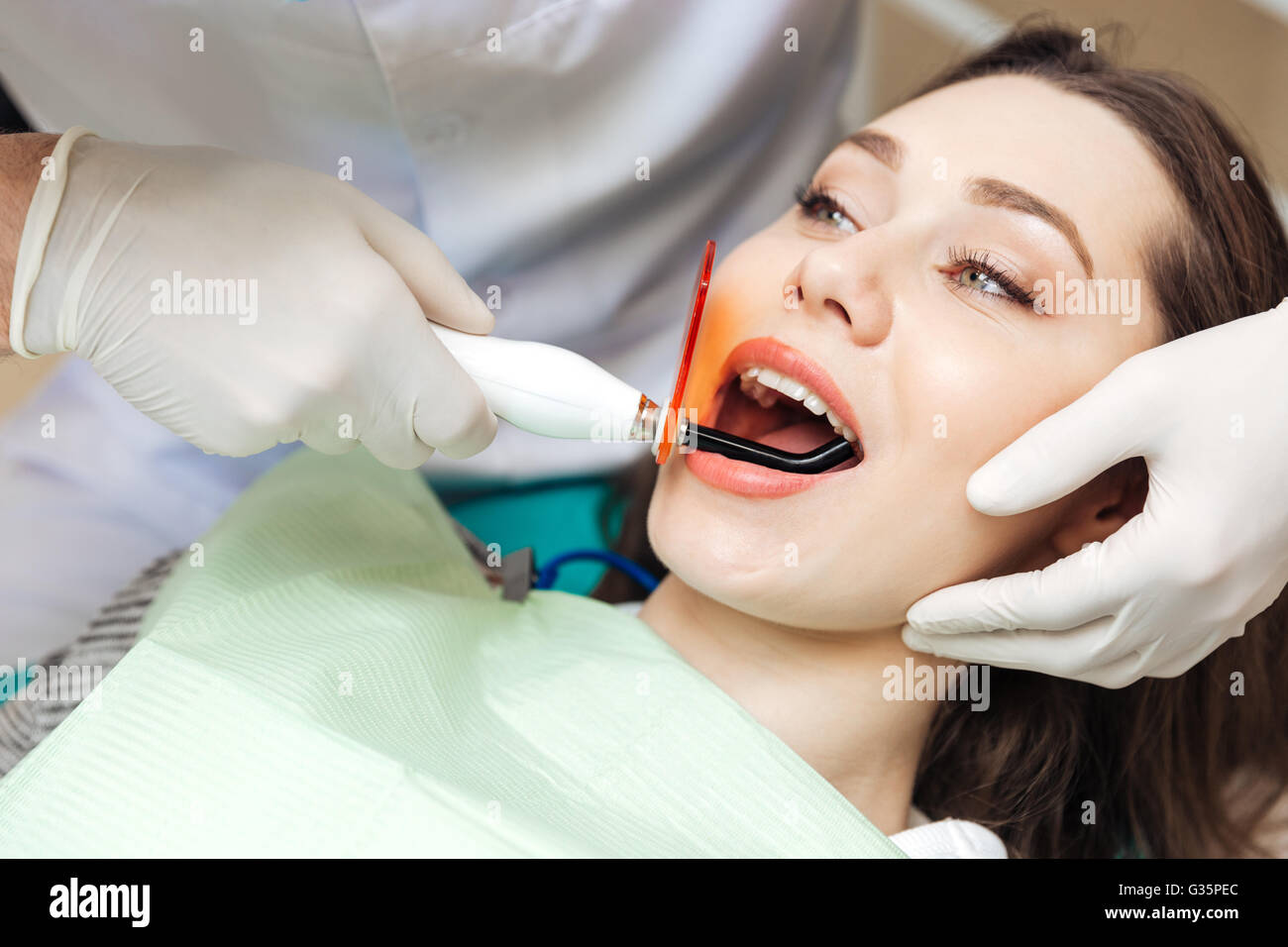 Bleaching of the teeth at dentist clinic. UV Whitening teeth. Repair  cracked or fractured teeth and remove teeth. Stock Photo